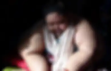 Pemadam Kebakaran Sampai Bobol Pintu dan Jendela untuk Angkat Dirinya, Titi Wati Bersiap untuk Jalani Operasi Ini