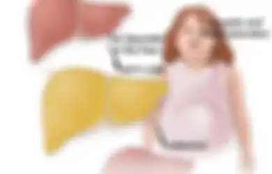 Penyakit Perlemakan Hati? Obati dengan Buah-buahan Terbaik Berikut