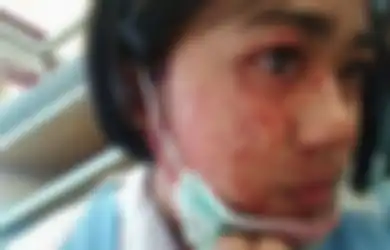 4 Kasus Kondisi Langka pada Manusia, Salah Satunya Wanita yang 'Nangis Darah’