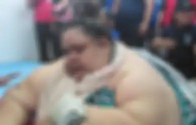 Menilik Kasus Titi Wati, Mungkinkah Obesitas karena Gorengan dan Air Es?