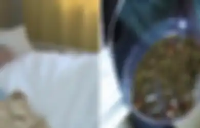 Akibat Jarang Sarapan dan Pola Makan Tak Teratur, 2.000 Batu Empedu Ditemukan dalam Tubuh Wanita Ini