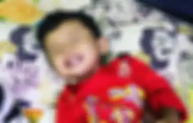 Digigit Serangga, Kaki Anak Ini Terinfeksi Bakteri Pemakan Daging dan Terancam Diamputasi