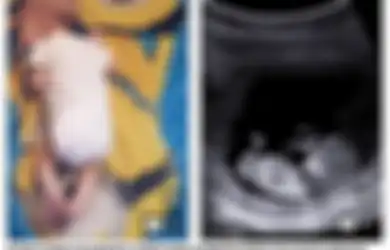 Sadis, Ibu Ini Biarkan Bayinya yang Berusia 2 Bulan Kelaparan dan Kekurangan Gizi Sampai Meninggal
