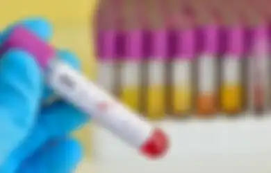 Ini Tanda dan Gejala HIV Setelah Satu Tahun Terinfeksi, yang Biasanya Terlihat Tanpa Gejala