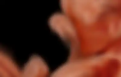 Arumi Bachsin Alami Keguguran: Ini 11 Faktor Risiko Ibu Hamil yang Bisa Alami Keguguran