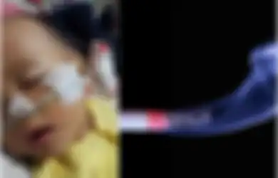 Gara-gara Ayahnya Perokok, Bayi Ini Derita Bronkopneumonia, Infeksi yang Mengancam Nyawa Bayi