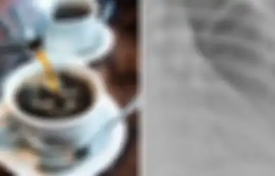 7 Tahun Minum 10 Gelas Kopi Setiap Hari, Wanita Ini Alami 'Hal Buruk' Pada Tubuhnya, Peringatan Bagi Pecinta Kopi