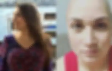 Sakit Perut Selama 9 Tahun, Wanita Ini Baru Tahu Ternyata Ia Menderita Kanker Ovarium