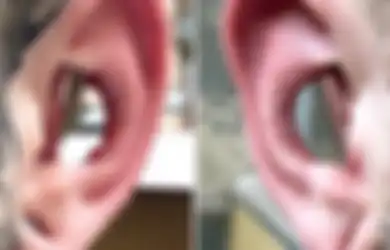 Conch Removal, Tren 'Melubangi' Bagian Tengah Telinga, Berani Coba?