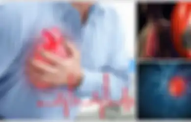 Peduli Tubuhmu: Mengenali Serangan Jantung Ringan yang Jangan Disepelekan