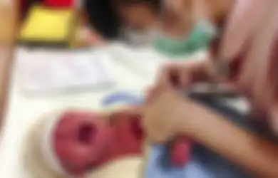 Akibat Makan Salad Selada Ketika Hamil, Wanita Ini Lahirkan Bayinya dengan Beberapa Gangguan Kesehatan