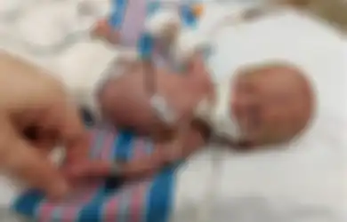 Walau Berat Badannya Hanya 310 Gram, Bayi Mungil Ini Dapat Bertahan Hidup dan Pulang dari NICU