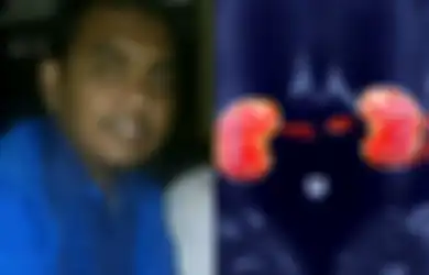 Kisah Pemilu 2014: Caleg Gagal Ingin Jual Ginjal Demi Bayar Utang Kampanye Rp420 juta