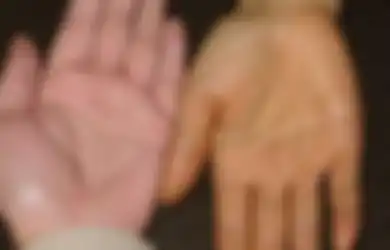 Perhatikan Tangan Anda, Jika Berubah Menjadi Kuning Setelah Makan Wortel Inilah yang Terjadi Pada Tubuh Anda