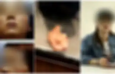 6 Bulan Setelah Jalani Operasi Hidung, Wanita Mengeluarkan Kapas saat Bersin