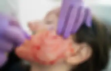 Lakukan Facial 'Vampir' Ala Kim Kardashian untuk Tampil Cantik, Dua Orang Wanita Justru Terkena HIV