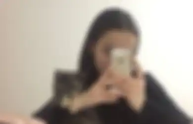 Tengkoraknya Retak Usai Jatuh dari Ketinggian 30 Meter Saat Ingin Selfie, Ajaibnya Gadis 15 Tahun Ini Selamat