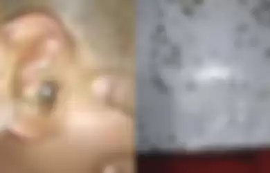 Video bocah menangis karena telinganya kemasukan semut.