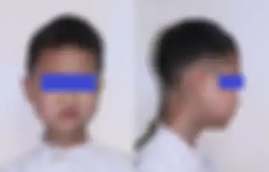 Selama 2 Tahun, Bocah Ini Hidup dengan Ranting Sepanjang 5 cm Tersangkut di Tenggorokannya