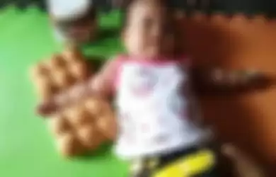 foto lengan bayi seperti roti sobek viral