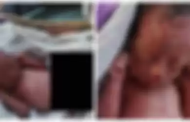 Bayi di Thailand ditemukan dengan kondisi tali pusar masih menempel dan sekujur tubuh penuh gigitan nyamuk