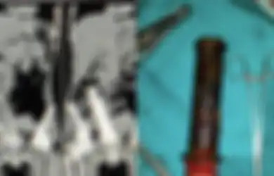 Suami Paksa Handle Motor Masuk ke Tubuh Istri Selama 2 Tahun: Ini 7 Benda Mengerikan yang Pernah Bersarang di Tubuh Manusia