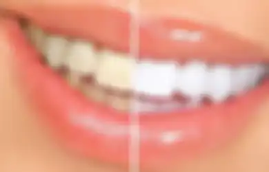 Ini 7 Penyakit yang Bisa Diungkap Lewat Gigi Anda, Mulai dari Diabetes Hingga Penyakit Autoimun