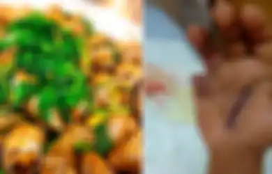 Jangan Sembarangan Makan Seafood, Kaki 2 Wanita Ini Tiba-tiba Bengkak dan Meninggal Sehari Setelah Dirawat