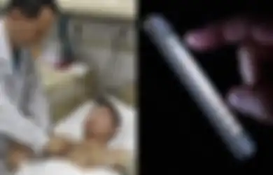 Masihkah Anda Suka Begadang Sambil Main Ponsel pada Tengah Malam? Pria 19 Tahun Ini Berakhir dengan Penyakit Mengerikan, Simak 5 Fakta Penting Berikut Ini