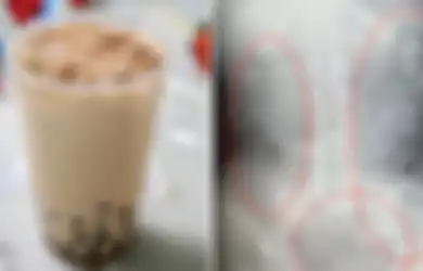 Sembelit dan Sakit Perut Selama 5 Hari, Ternyata Ada Lebih dari 100 'Bubble Tea' dalam Perut dan Usus Gadis Ini