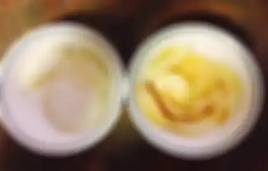 Campurkan Bawang dan Gula, Paduan Keduanya Berkhasiat untuk Mengobati Pilek, Bahkan Batuk