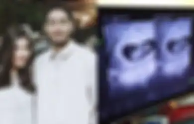 Syahnaz Sadiqah Hamil Bayi Kembar: Ini 5 Faktor yang Paling Berpengaruh dalam Mendapatkan Bayi Kembar
