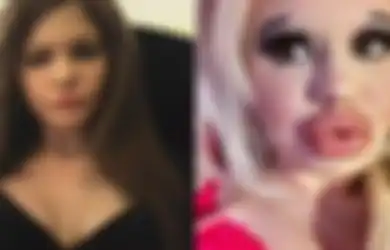 Ingin Mirip Boneka Barbie, Mahasiswa Cantik Ini Lakukan Operasi Plastik, Tapi Hasilnya Malahan Membuatnya dapat Julukan Ini