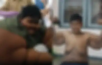 Arya Permana akan Jalani Operasi Pengangkatan Gelambir, Ini Operasi Baratrik yang Berhasil Turunkan Berat Badannya dari 192 Kg Jadi 85 Kg