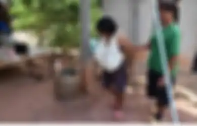 Alami Kondisi Aneh, Payudara Wanita Ini Terus Membesar Tak Beraturan dan Membuatnya Terbebani
