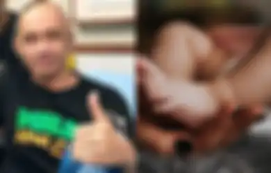 Agung Hercules Idap Kanker Otak: Hati-hati, Anak Sering Kejang Bisa Jadi Penanda Awal Tumor Otak pada Anak
