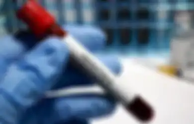 Belum Banyak yang Tahu, Di Musim Hujan  Risiko  Hepatitis A meningkat