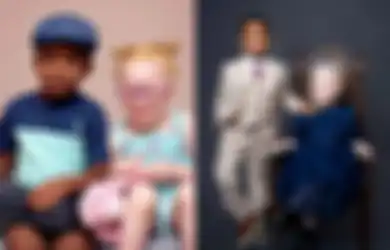 ‘Orang Tidak Percaya Anak Saya Kembar Karena Warna Kulit Mereka Berbeda’