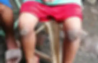 Tinggalkan Tas di Sekolah, Bocah 8 Tahun Dihukum Ibunya Berlutut di Atas Bara Api hingga Kakinya Melepuh