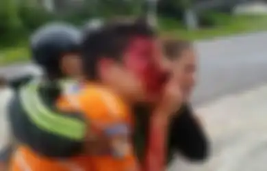 Protes Warga Kekurangan Bahan Bakar Padahal Negara Kaya Minyak, Remaja 16 Tahun Buta Setelah Terima Peluru di Matanya