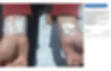 Benarkah dengan Menempelkan Bawang Putih Pada Tangan Bisa Sembuhkan Sakit Gigi?