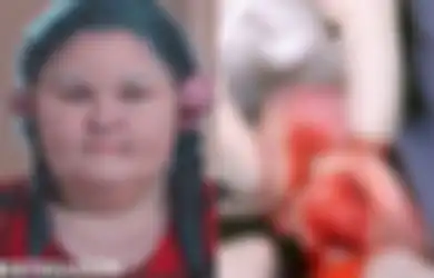 Lakukan Tindik di Bagian Tak Biasa, Telinga Wanita Ini Ditumbuhi Benjolan Daging Seberat Hampir Setengah Kilogram