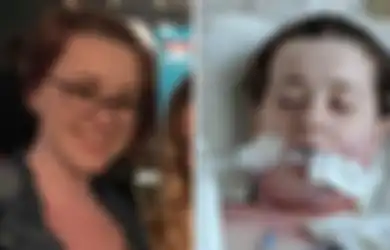 7 Giginya Dicabut untuk Pasang Behel, Nyawa Gadis Ini Hampir Melayang