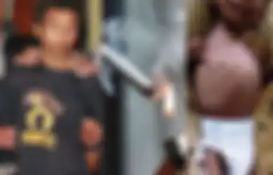 Kisah Pilu DDS, Bayi 2 Tahun Penderita Gizi Buruk yang Sering Disulut Rokok dan Dipukuli Hingga Patah Tulang oleh Ayahnya Hanya karena Sering Menangis