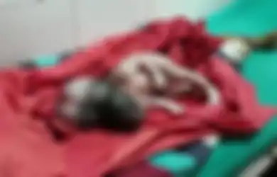 Tak Alami Komplikasi Selama Kehamilan, Seorang Wanita Melahirkan Bayi Perempuan dengan 'Tiga Kepala' yang Memprihatinkan