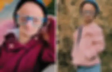 Menua Tujuh Kali Lebih Cepat, Ini Kisah Claudia, Wanita Berusia 20 Tahun yang Terlihat Seperti Berusia 140 Tahun