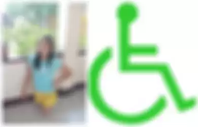 Menyedihkan! Seorang Wanita Dilarang Penyandang Disabilitas Dilarang Masuk Kantor Pemerintahan Hanya Karena Pakai Celana Pendek