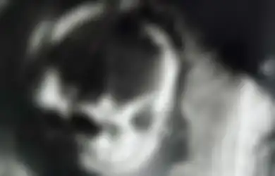 Tampak Mengerikan Sampai Ibunya Ketakutan di Ultrasound, Beginilah Kondisi Bayi Ini Setelah Dilahirkan