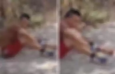 Meski Lengannya Terputus Usai Alami Kecelakan, Pria di Video Ini Tetap Bisa Berduduk Santai, Loh!