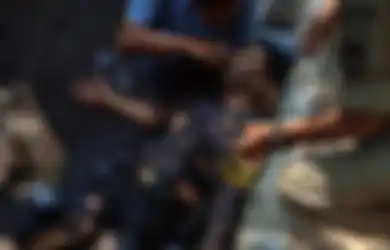Kondisi Aiptu Erwin Alami Luka Bakar 80%, Kondisinya Mengenaskan, Jaringan Kulit dan Otot Rusak